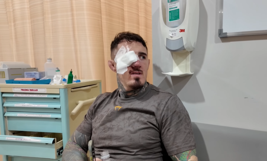 Tom Aspinall in the hospital after an eye injury