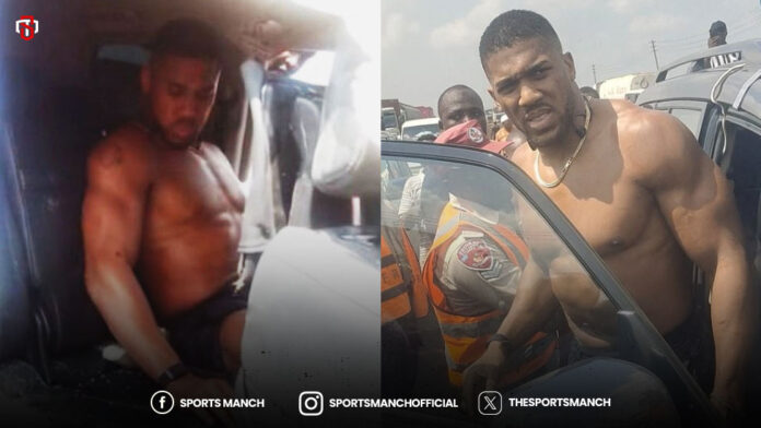 Photo of Anthony Joshua following his car crash in Nigeria